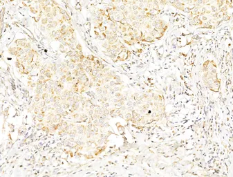 Anti-p70 S6K (phospho Thr389/Thr412) antibody used in IHC (Paraffin sections) (IHC-P). GTX05173