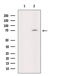 Anti-p70 S6K (phospho Thr389/Thr412) antibody used in Western Blot (WB). GTX05173