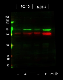 Anti-p70 S6K (phospho Thr389/Thr412) antibody used in Western Blot (WB). GTX05173
