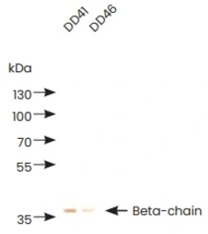 Anti-D-Dimer antibody [DD46] used in  (). GTX05175