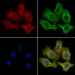 Anti-PKD2 antibody used in Immunocytochemistry/ Immunofluorescence (ICC/IF). GTX05176