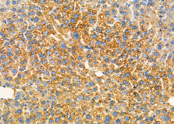 Anti-PKD2 antibody used in IHC (Paraffin sections) (IHC-P). GTX05176