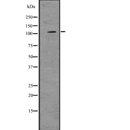 Anti-PKD2 antibody used in Western Blot (WB). GTX05176