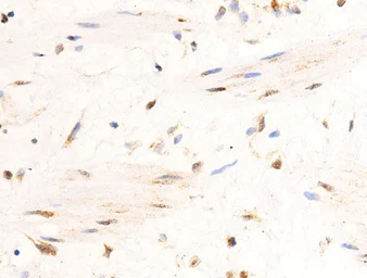 Anti-UCP3 antibody used in IHC (Paraffin sections) (IHC-P). GTX05177