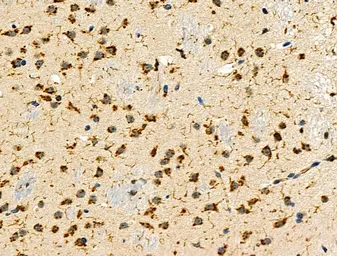 Anti-UCP3 antibody used in IHC (Paraffin sections) (IHC-P). GTX05177