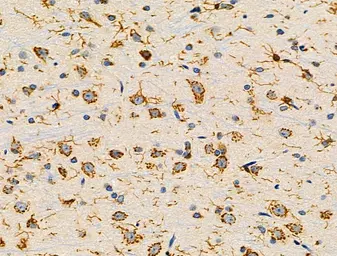 Anti-UCP3 antibody used in IHC (Paraffin sections) (IHC-P). GTX05177
