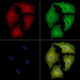 Anti-Defensin alpha 5 antibody used in Immunocytochemistry/ Immunofluorescence (ICC/IF). GTX05178