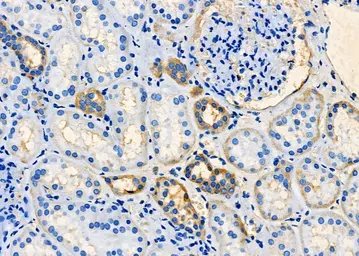 Anti-TARC antibody used in IHC (Paraffin sections) (IHC-P). GTX05179