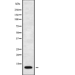 Anti-TARC antibody used in Western Blot (WB). GTX05179