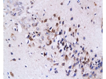 Anti-Fas Ligand antibody used in IHC (Paraffin sections) (IHC-P). GTX05180