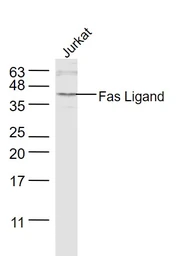 Anti-Fas Ligand antibody used in Western Blot (WB). GTX05180