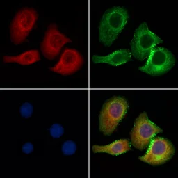 Anti-CBX7 antibody used in Immunocytochemistry/ Immunofluorescence (ICC/IF). GTX05181