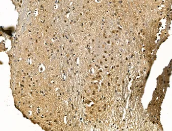 Anti-CBX7 antibody used in IHC (Paraffin sections) (IHC-P). GTX05181