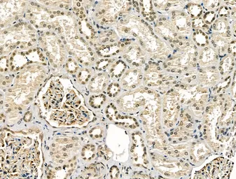 Anti-CBX7 antibody used in IHC (Paraffin sections) (IHC-P). GTX05181
