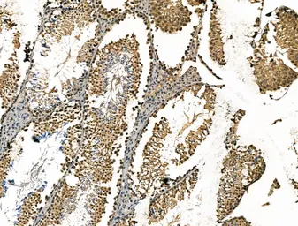 Anti-CBX7 antibody used in IHC (Paraffin sections) (IHC-P). GTX05181