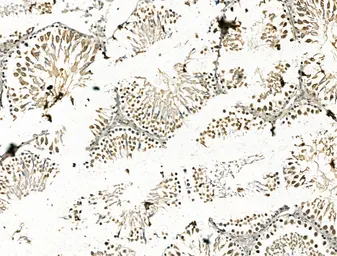 Anti-CBX7 antibody used in IHC (Paraffin sections) (IHC-P). GTX05181
