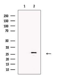 Anti-CBX7 antibody used in Western Blot (WB). GTX05181