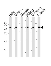 Anti-CBX7 antibody used in Western Blot (WB). GTX05182