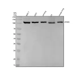 Anti-EPHB3 antibody [25E49] used in Western Blot (WB). GTX05183