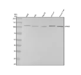 Anti-EPHB3 antibody [25E49] used in Western Blot (WB). GTX05183