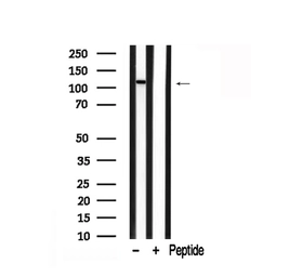 Anti-PLD1 antibody used in Western Blot (WB). GTX05184
