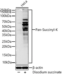 Anti-Succinyl Lysine antibody [ARC55837] used in Western Blot (WB). GTX05185