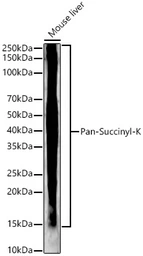 Anti-Succinyl Lysine antibody [ARC55837] used in Western Blot (WB). GTX05185