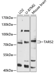 Anti-TARS2 antibody used in Western Blot (WB). GTX05186