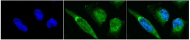 Anti-Grp78 antibody used in Immunocytochemistry/ Immunofluorescence (ICC/IF). GTX05188