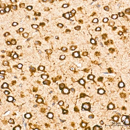 Anti-Grp78 antibody [AMC0725] used in IHC (Paraffin sections) (IHC-P). GTX05189