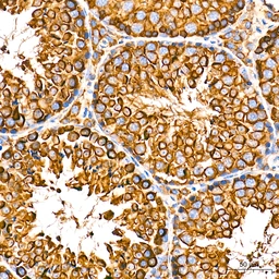 Anti-Grp78 antibody [AMC0725] used in IHC (Paraffin sections) (IHC-P). GTX05189
