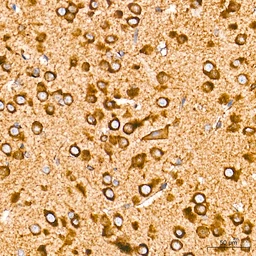 Anti-Grp78 antibody [AMC0725] used in IHC (Paraffin sections) (IHC-P). GTX05189