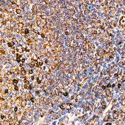 Anti-Grp78 antibody [AMC0725] used in IHC (Paraffin sections) (IHC-P). GTX05189
