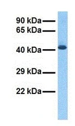 Anti-TM6SF2 antibody used in Western Blot (WB). GTX05190