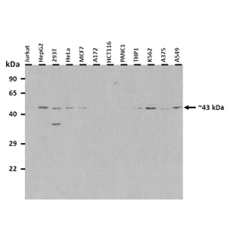 Anti-TM6SF2 antibody used in Western Blot (WB). GTX05190