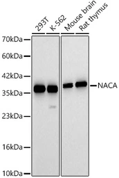 Anti-NACA antibody used in Western Blot (WB). GTX05192