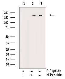 Anti-FANCD2 (phospho Ser222) antibody used in Western Blot (WB). GTX05195