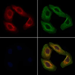 Anti-POMGNT1 antibody used in Immunocytochemistry/ Immunofluorescence (ICC/IF). GTX05196