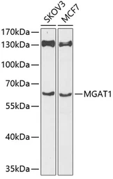 Anti-MGAT1 antibody used in Western Blot (WB). GTX05197