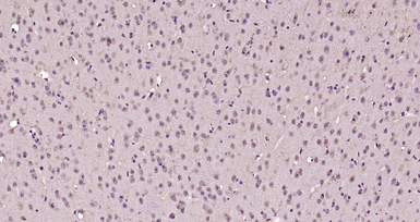 Anti-EGR2 antibody used in IHC (Paraffin sections) (IHC-P). GTX05198