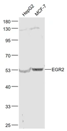 Anti-EGR2 antibody used in Western Blot (WB). GTX05198