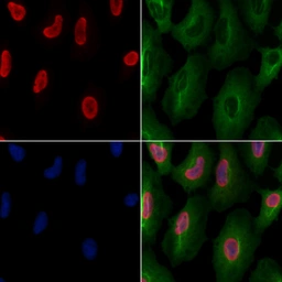 Anti-DDX5 antibody used in Immunocytochemistry/ Immunofluorescence (ICC/IF). GTX05200