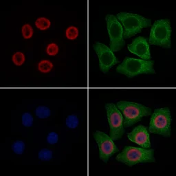 Anti-DDX5 antibody used in Immunocytochemistry/ Immunofluorescence (ICC/IF). GTX05200