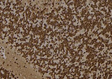 Anti-DDX5 antibody used in IHC (Paraffin sections) (IHC-P). GTX05200