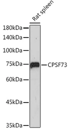 Anti-CPSF73 antibody [ARC2567] used in Western Blot (WB). GTX05201