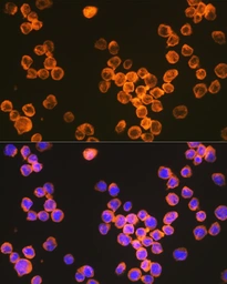 Anti-DC-SIGN antibody [ARC1679] used in Immunocytochemistry/ Immunofluorescence (ICC/IF). GTX05202