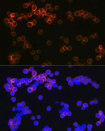 Anti-DC-SIGN antibody [ARC1679] used in Immunocytochemistry/ Immunofluorescence (ICC/IF). GTX05202