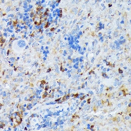 Anti-DC-SIGN antibody [ARC1679] used in IHC (Paraffin sections) (IHC-P). GTX05202