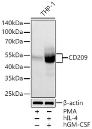Anti-DC-SIGN antibody [ARC1679] used in Western Blot (WB). GTX05202