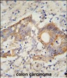 Anti-HHLA2 antibody used in IHC (Paraffin sections) (IHC-P). GTX05203